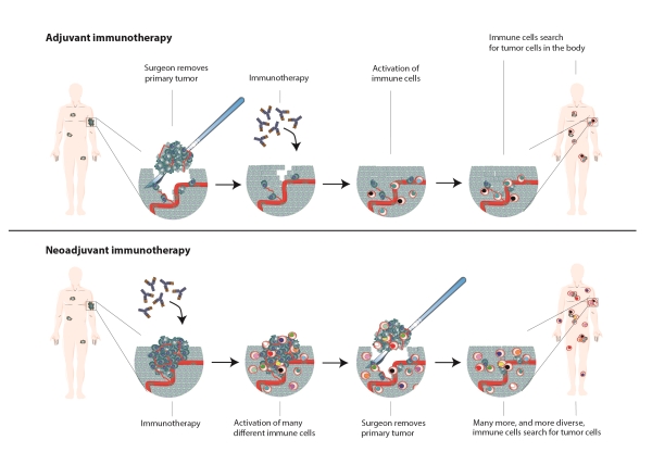 Immune System Deserves Priority