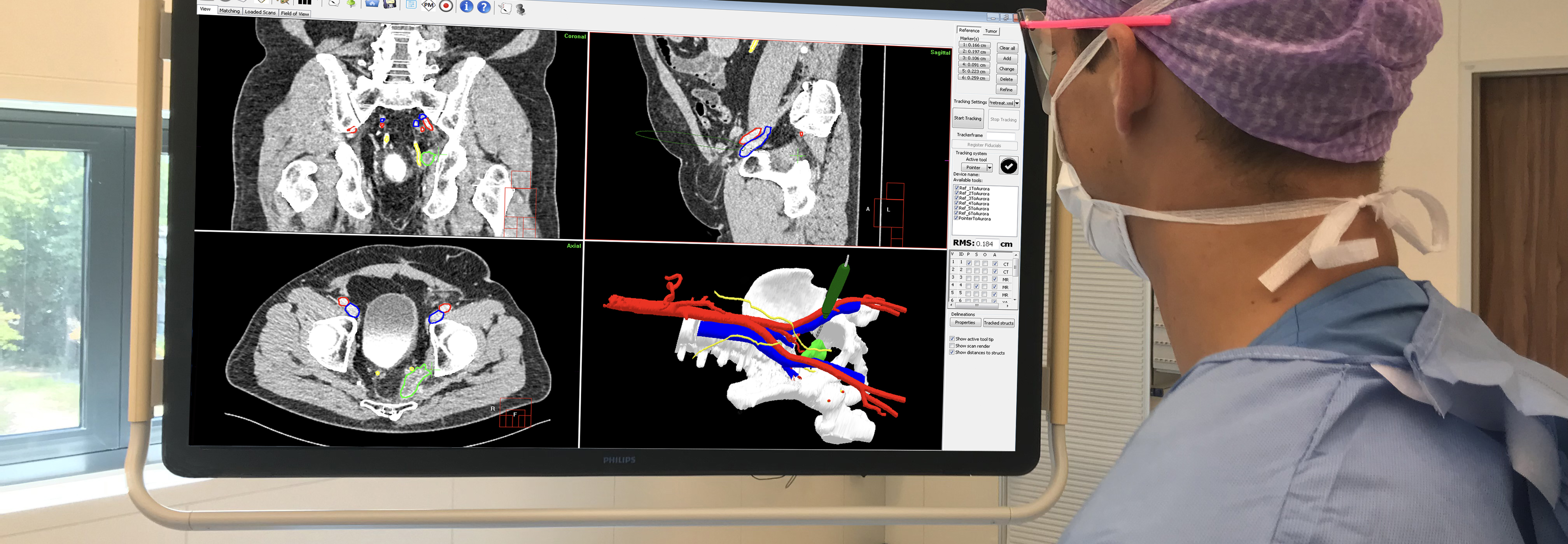 Surgicalnavigation