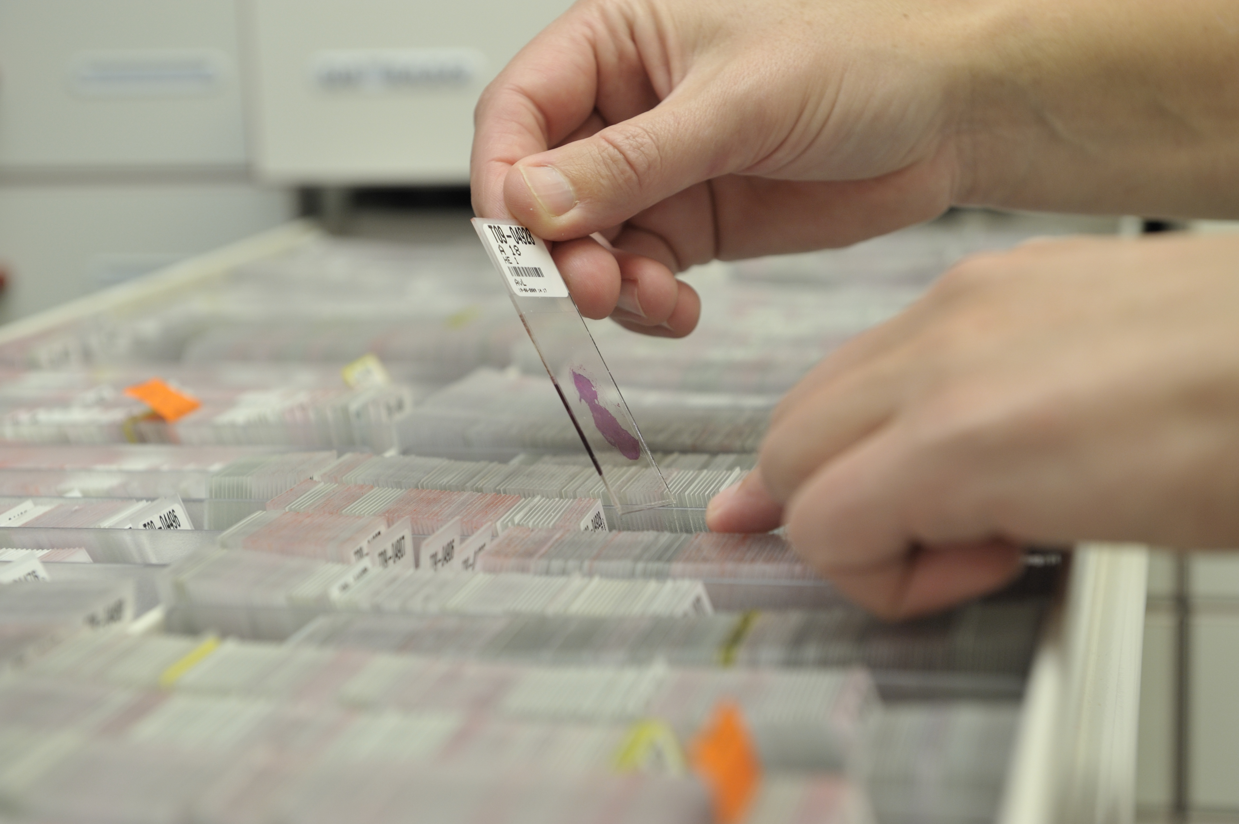 Precision Oncology