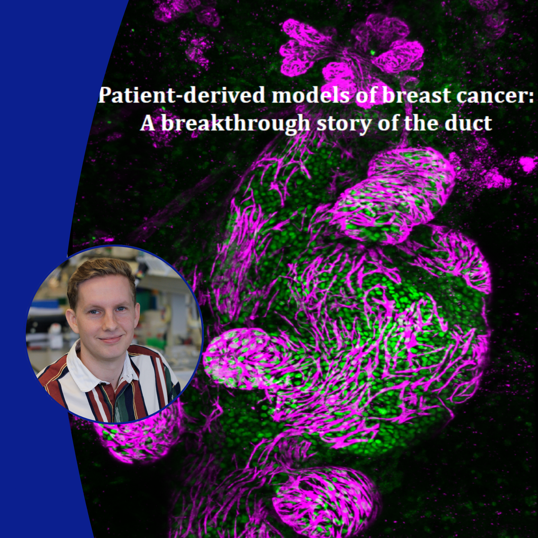 "In the majority of these women, the tumor will never leave the milk ducts"