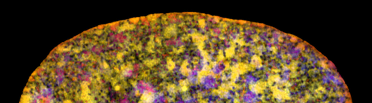 <p>Chromatin inside a cell nucleus</p>