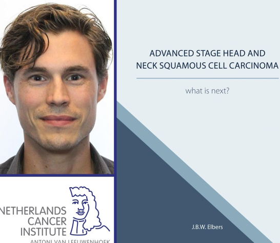 Thesis Defense Jos Elbers Good Results Of Immunotherapy In Patients With Head And Neck Cancer Preview Photo 1
