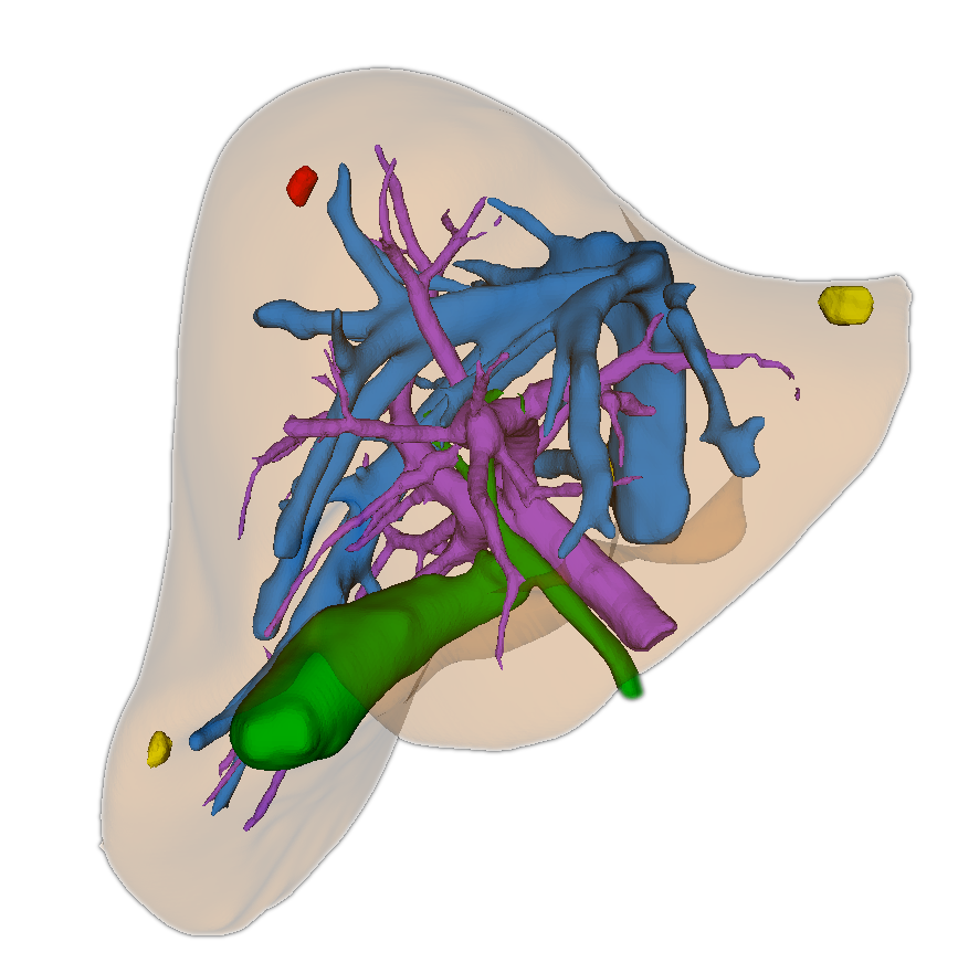 Liver Tumor