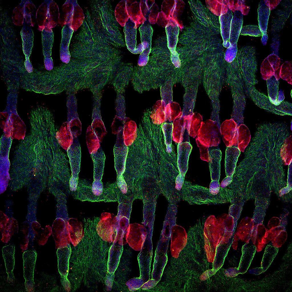 <p>This image shows hair follicles in a piece of mouse skin. In green you can see integrin beta4, which plays an important role in strengthening and stabilizing the skin. Connected to the hair follicles you can see the sebaceous glands (in red). Cell nuclei are shown in blue.</p>