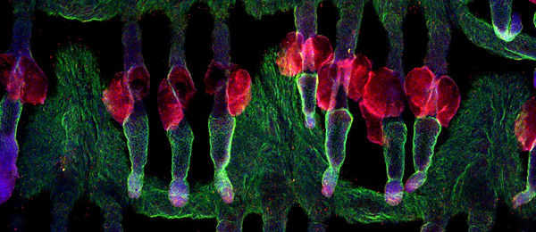 This image shows hair follicles in a piece of mouse skin. In green you can see integrin beta4, which plays an important role in strengthening and stabilizing the skin. Connected to the hair follicles you can see the sebaceous glands (in red). Cell nuclei are shown in blue.