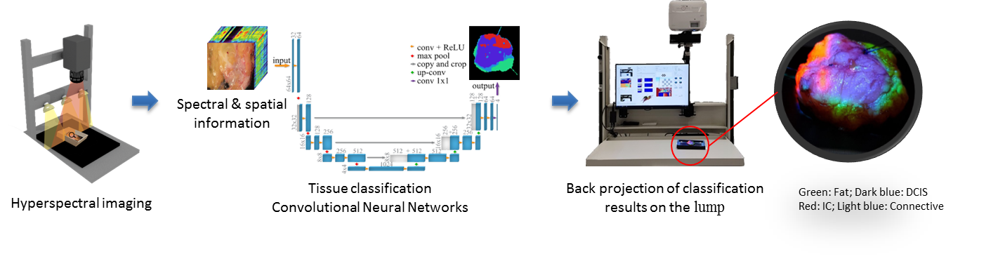 Backprojection