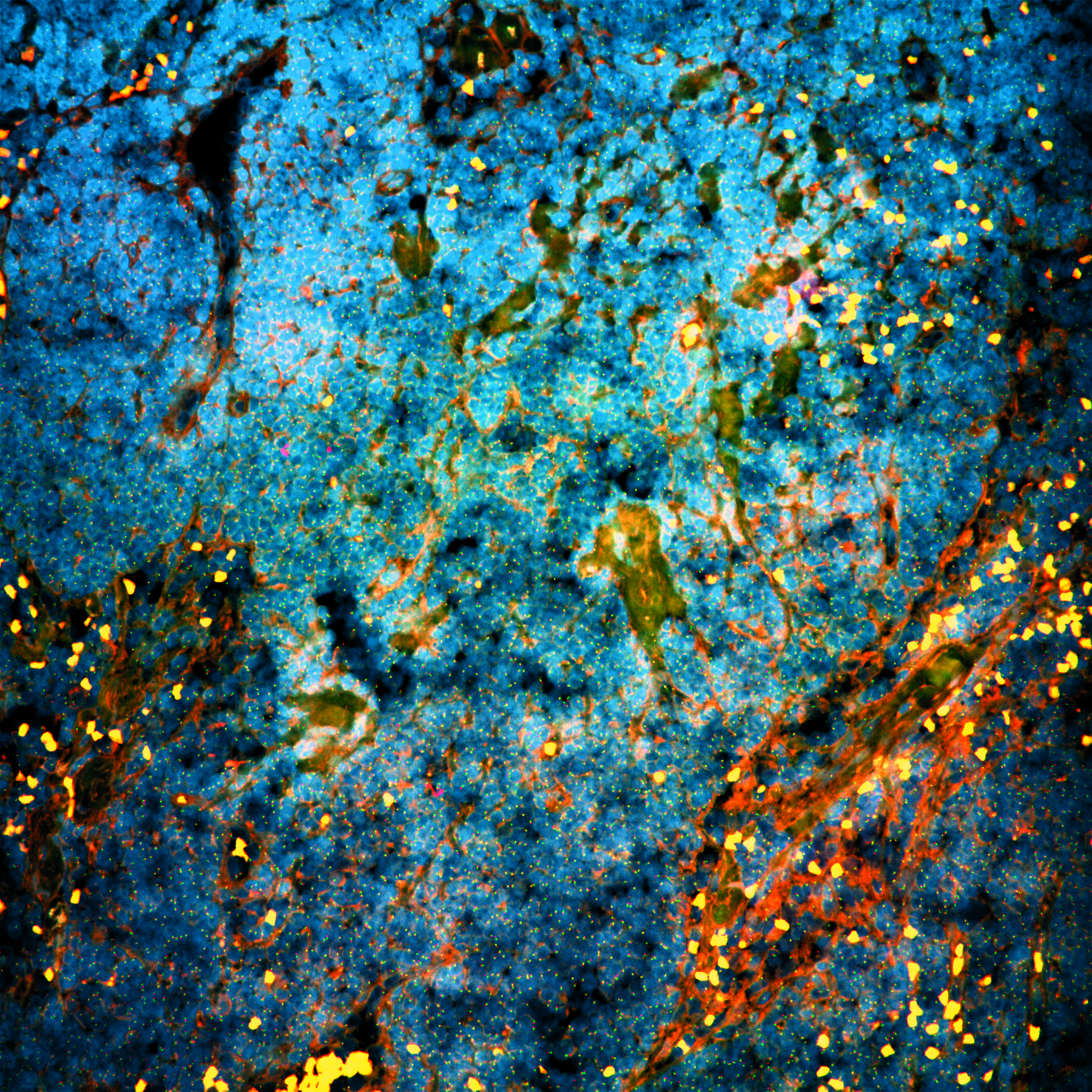 Banner Wilbert Zwart Lymphnode Universe CMYK