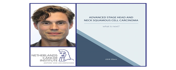 Thesis Defense Jos Elbers Good Results Of Immunotherapy In Patients With Head And Neck Cancer