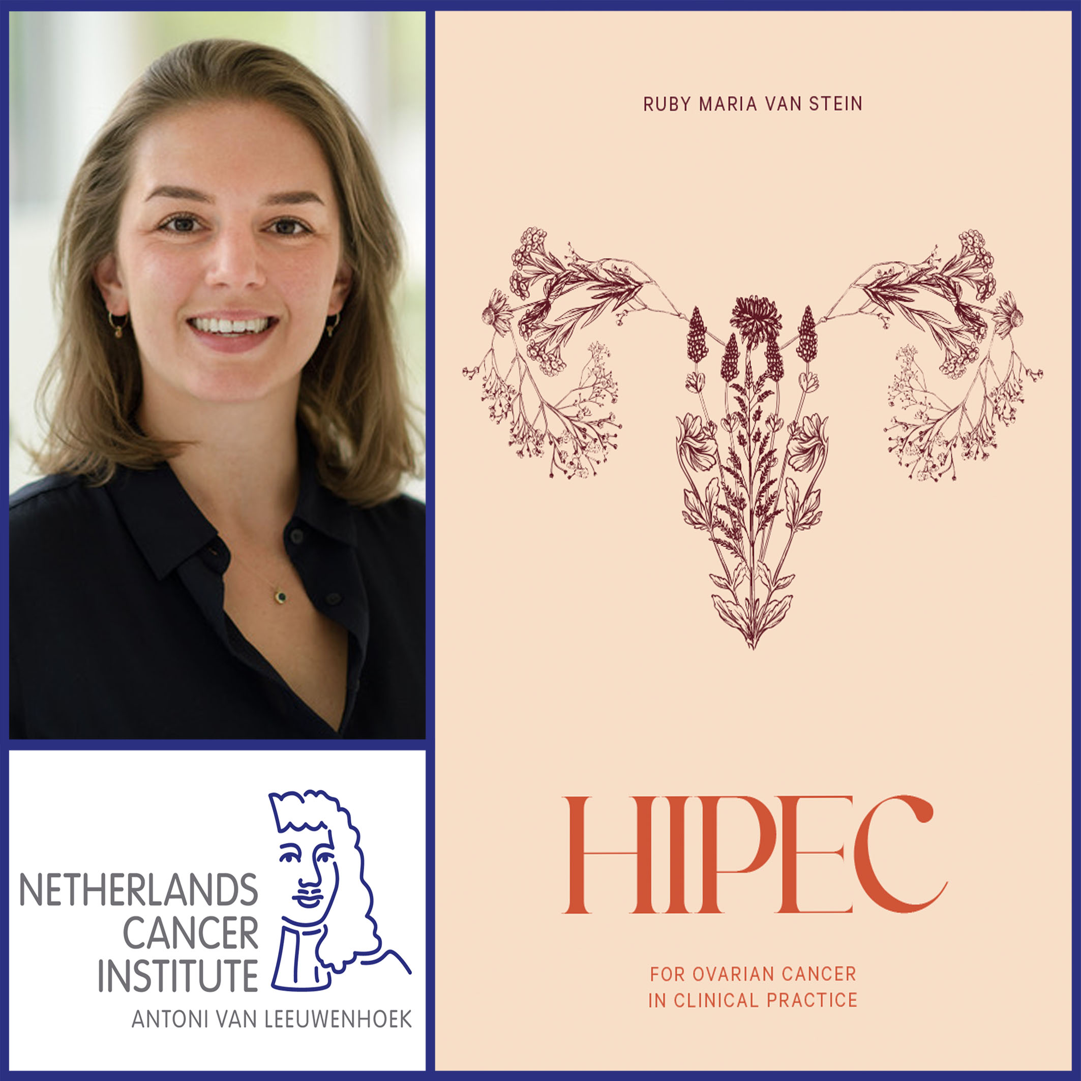 Thesis defense Ruby van Stein