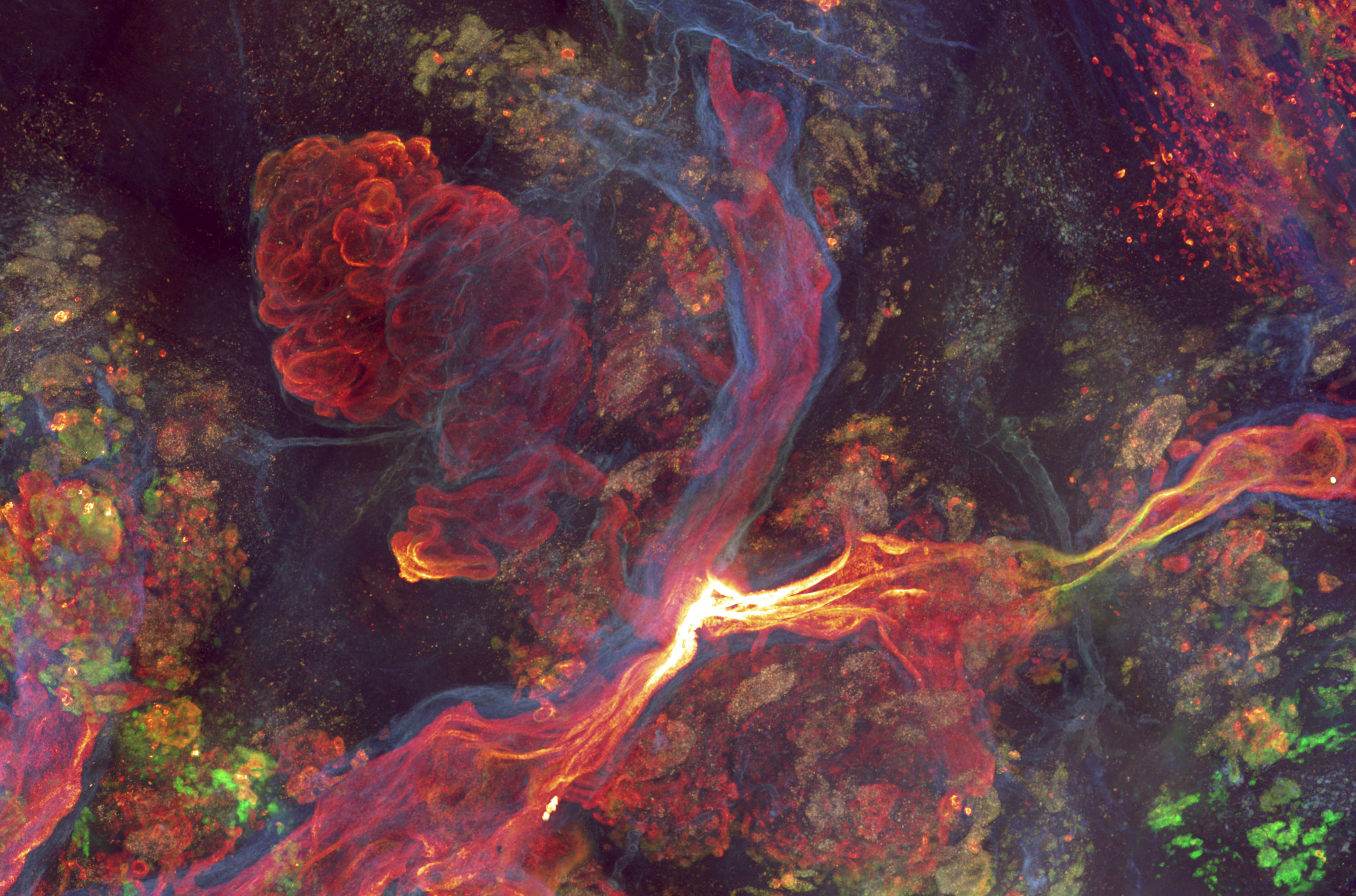 3D Pancreas Copy