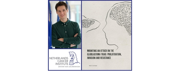 Mark de Gooijer PHD - Brain tumor requires combination therapy