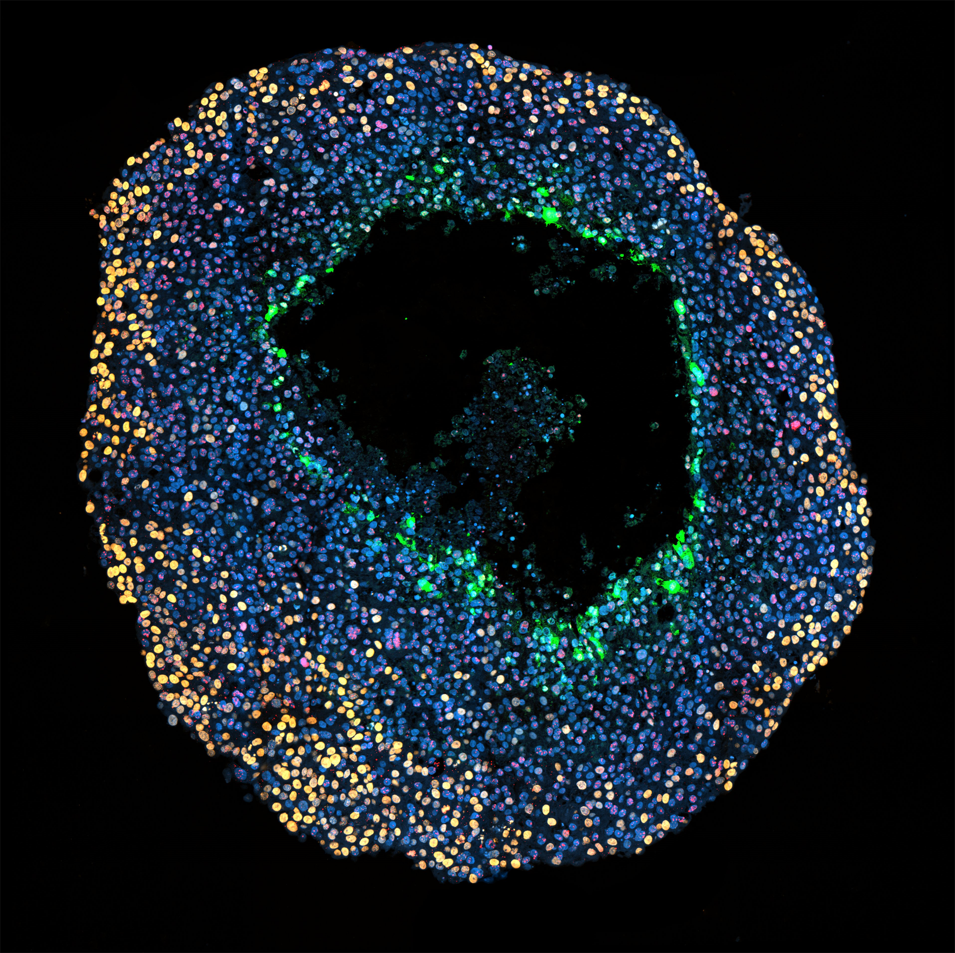 Multicellular spheroid