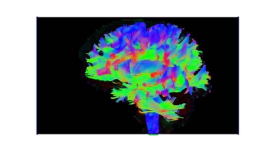 Brainview2