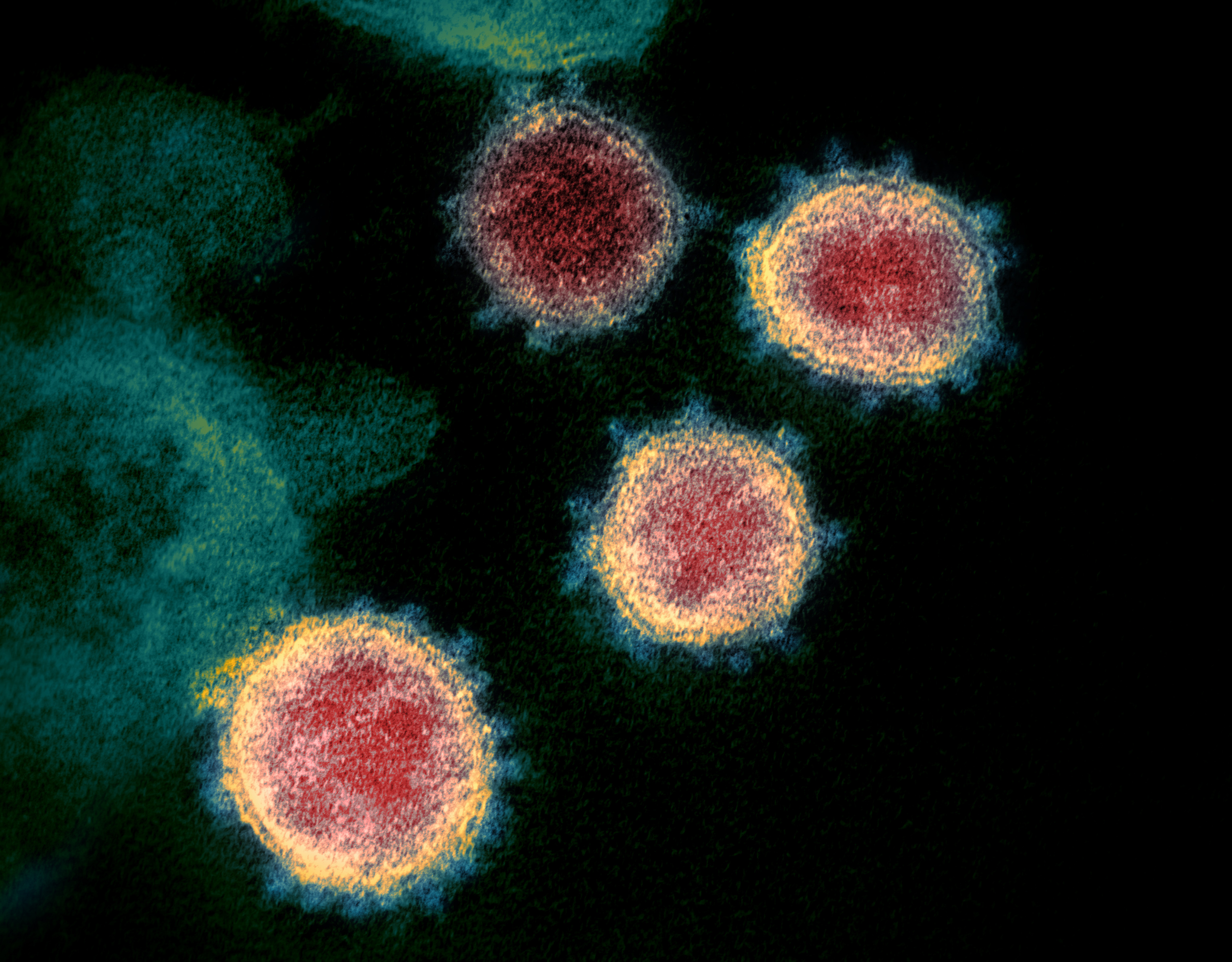 Novel Coronavirus SARS Cov 2 Wikimedia