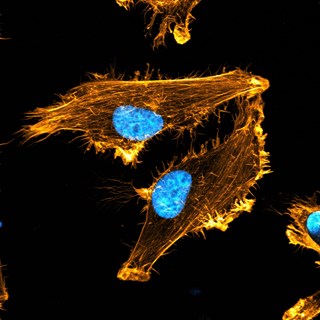 Actin 2 with blue nucleus