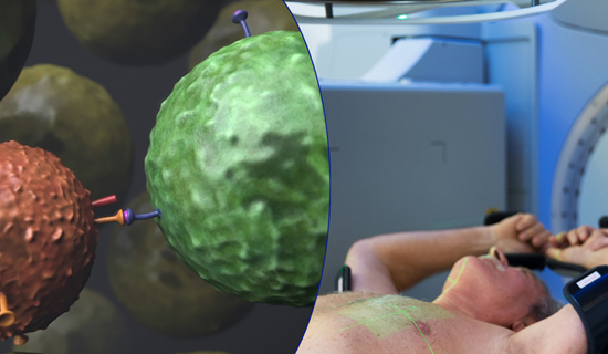 Immuun En Radiotherapie Nki