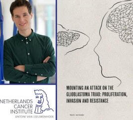 Brain Tumor Requires Combination Therapy 1