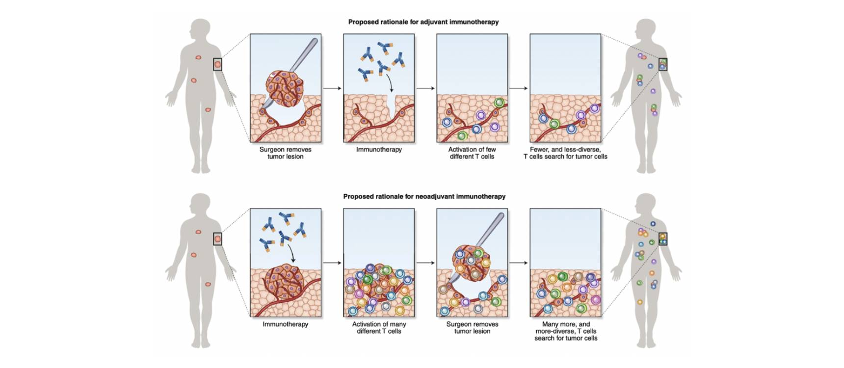 Proposed Rationale Neoadjavent Immunotherapy (1)