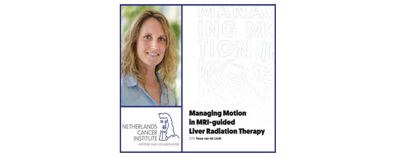 MRI-movie exposes liver tumor