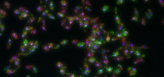 Microscopic image of yeast cells. Each red or green dot represents one RNA molecule, which ultimately determine the cell’s behavior.