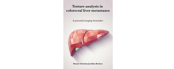 Rianne Beckers Thesis