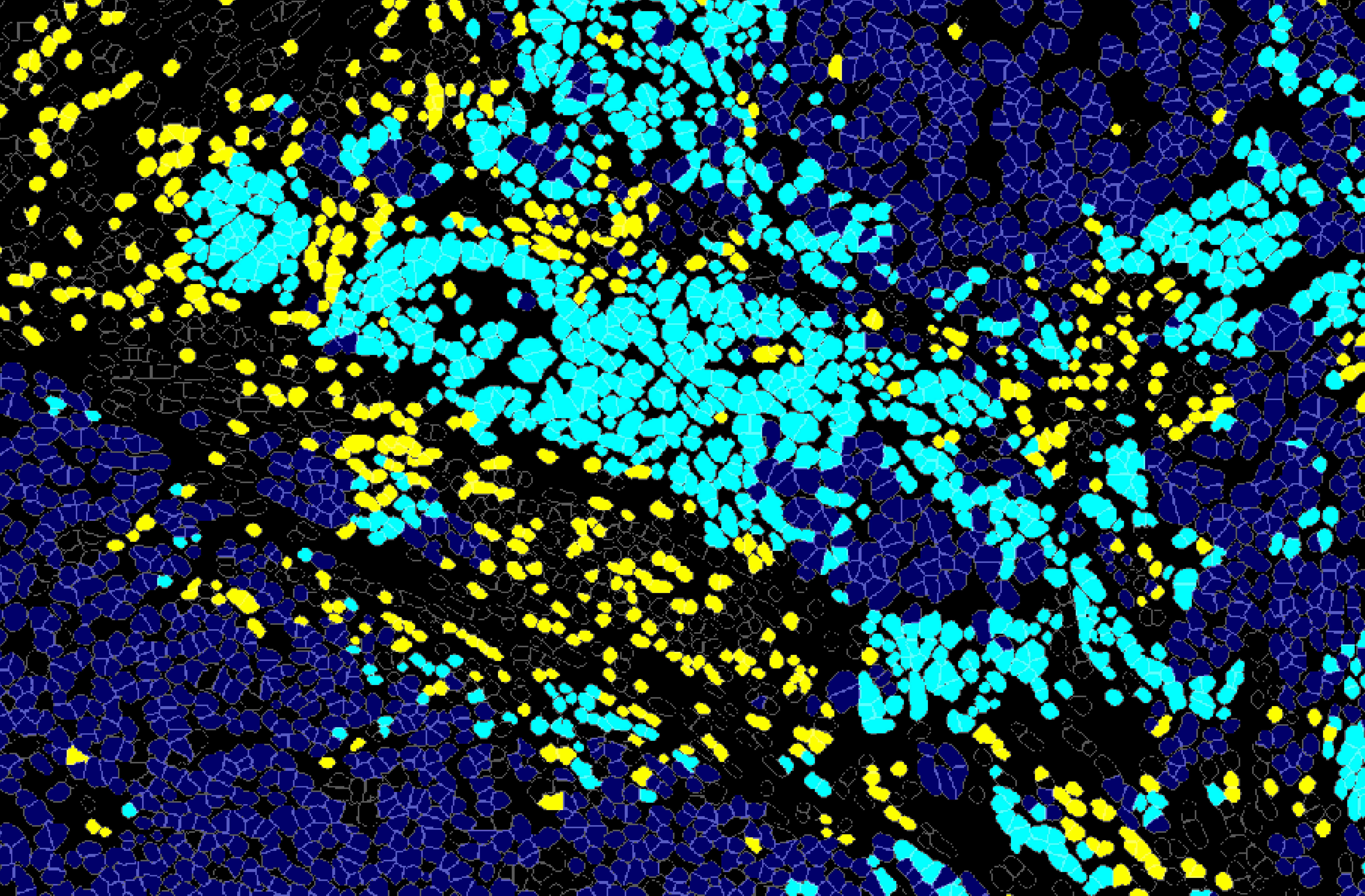 Cancer Discovery Horlings Ea 2