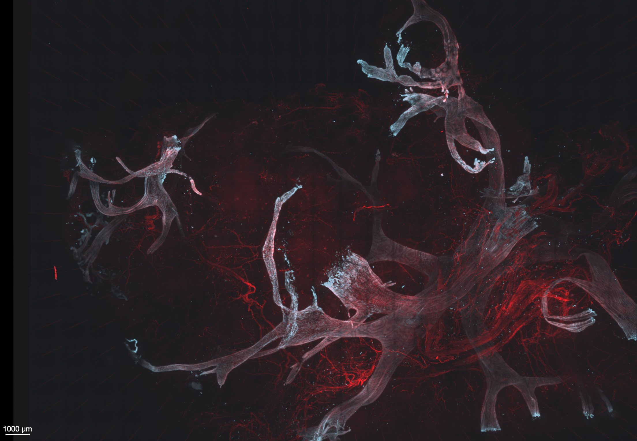 <p>With 3D whole organ microscopy Hendrik Messal visualises milk ducts in breasts. </p>
