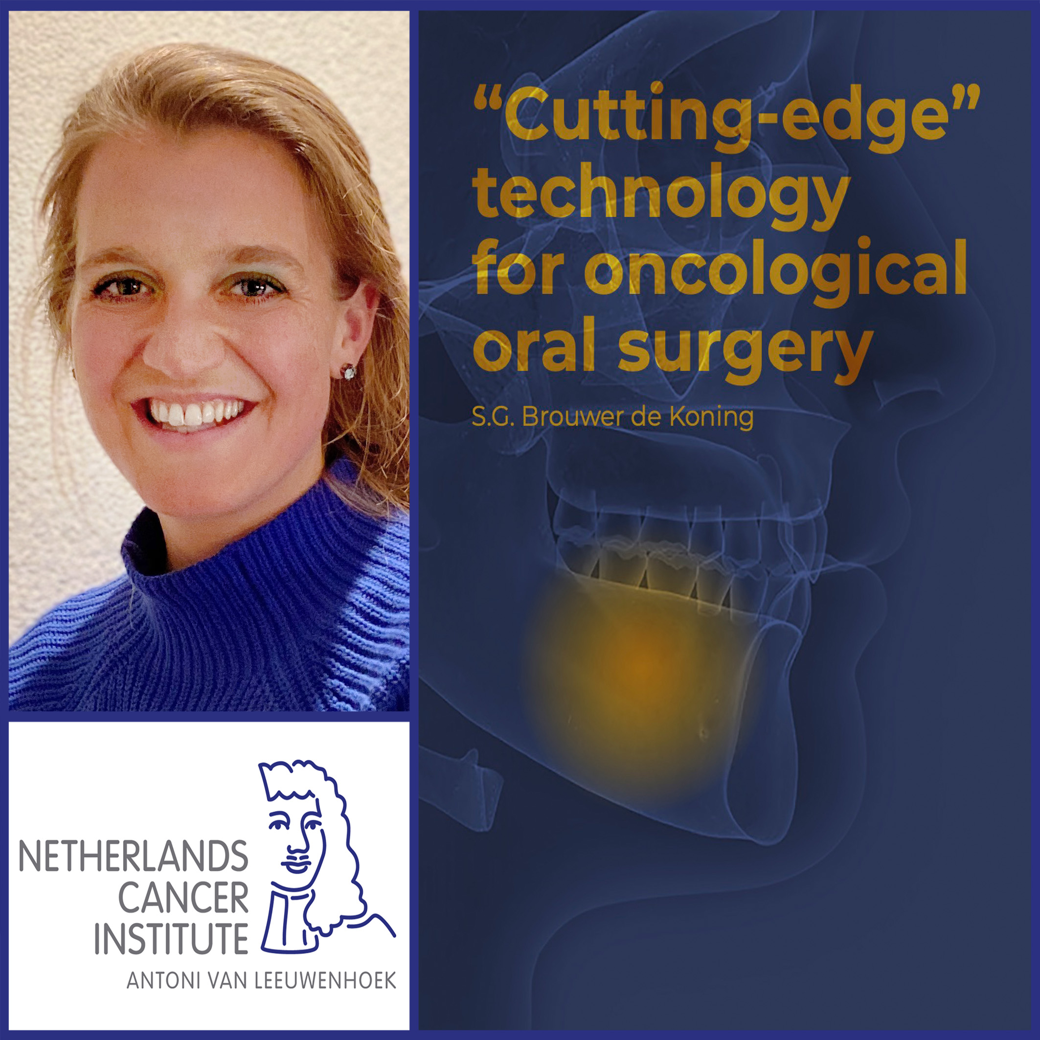 Thesis defense Susan Brouwer de Koning 