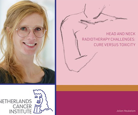 Thesis Defense Jolien Heukelom More Effective Adaptive Radiotherapy Preview Photo 1