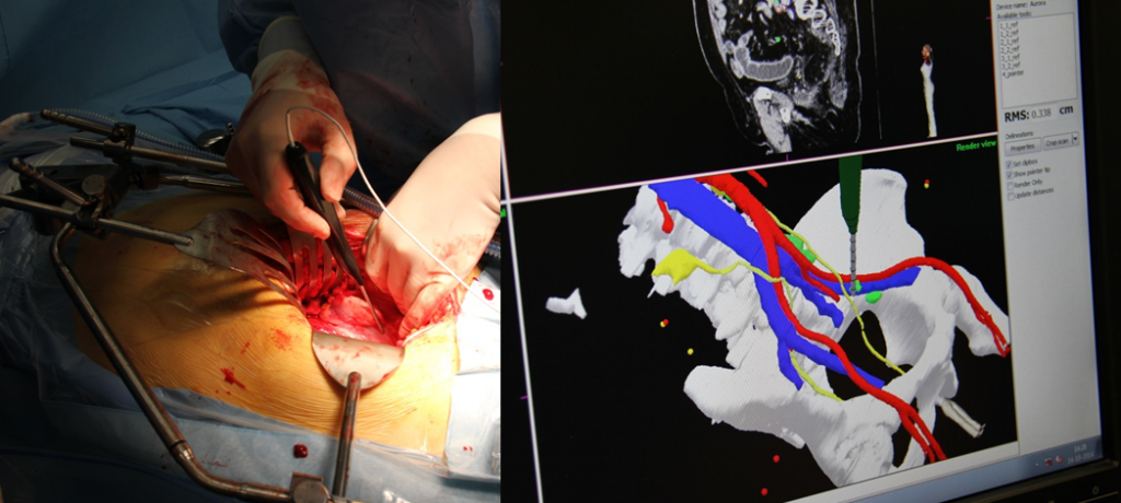 Surgical Navigation