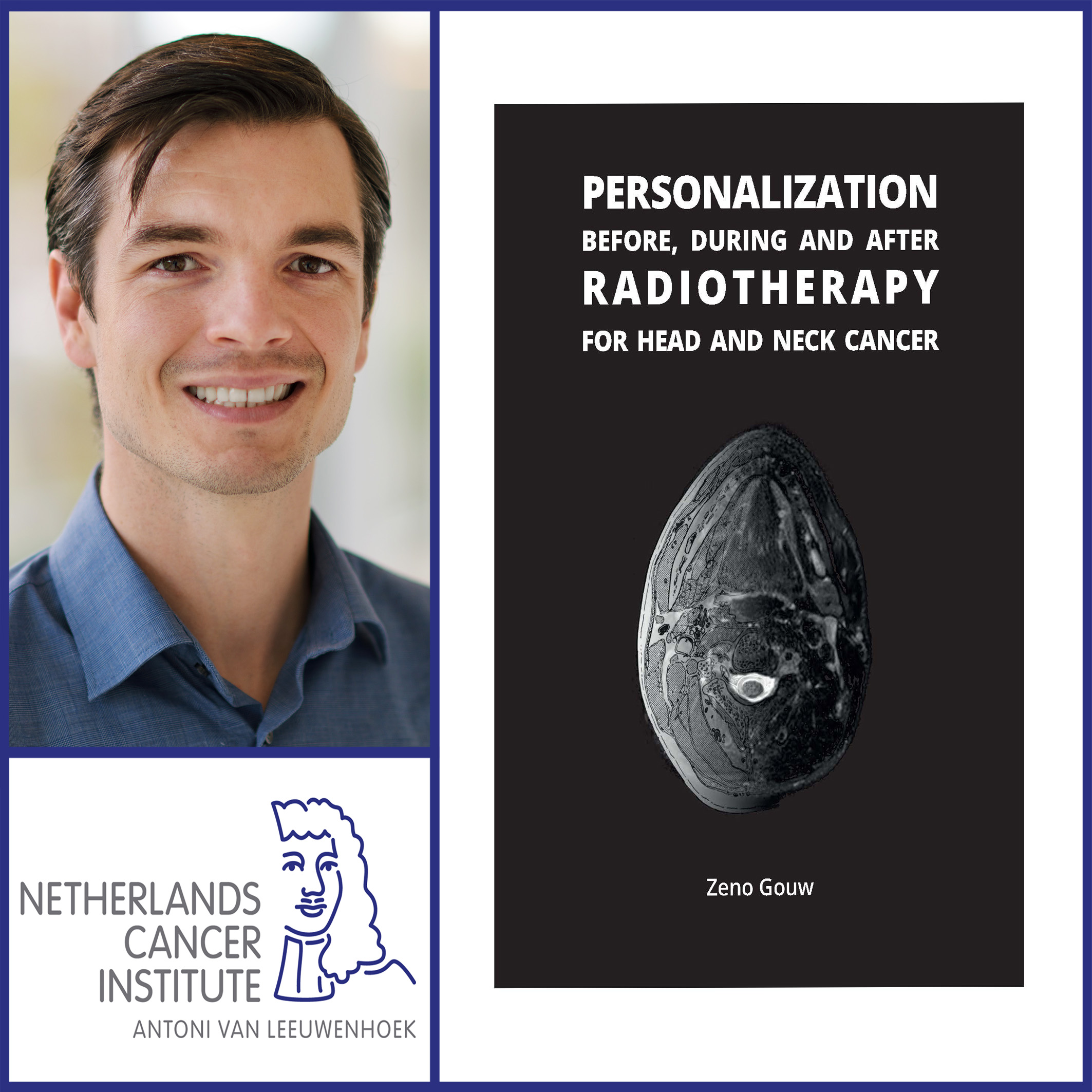 Thesis defense Zeno Gouw