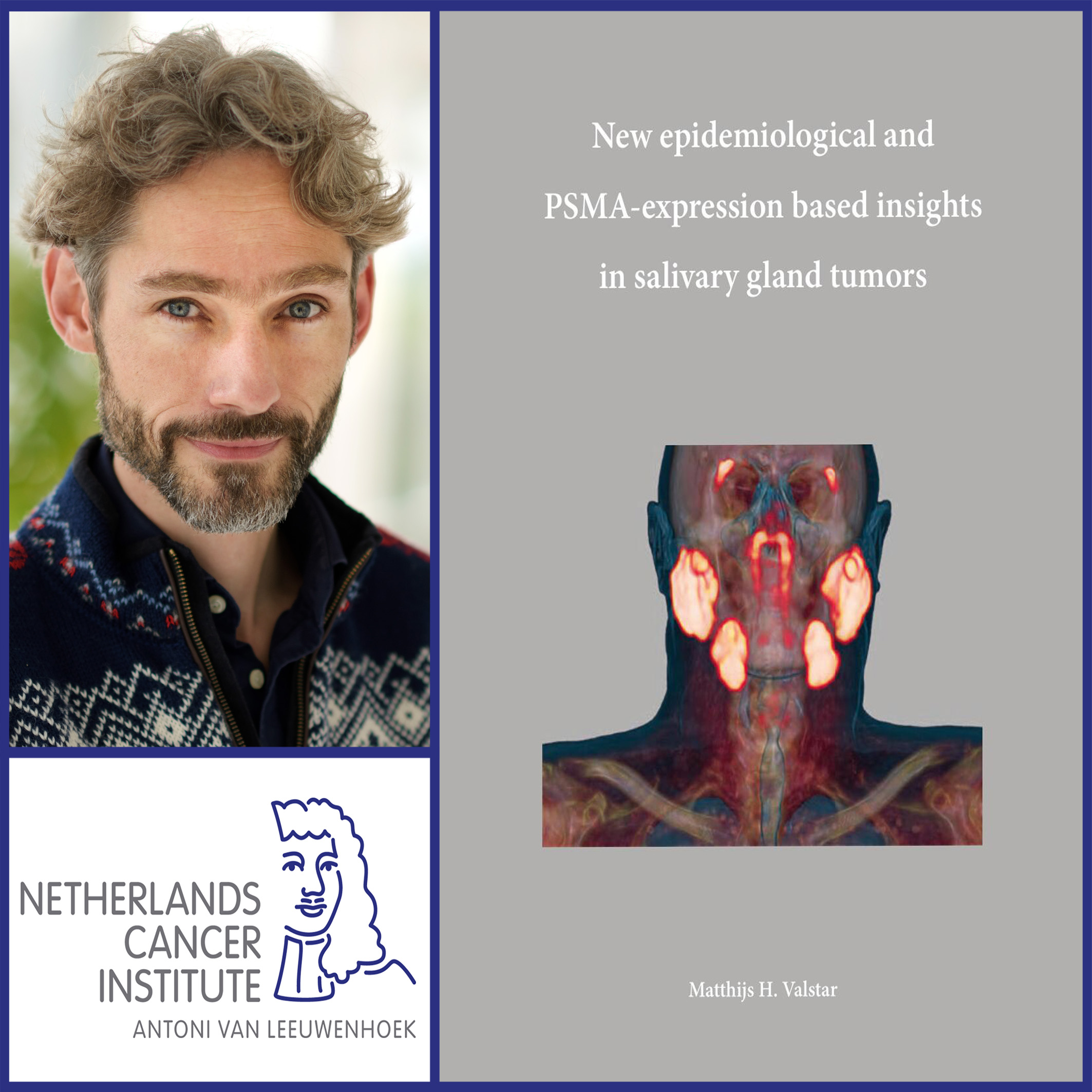Thesis defense Matthijs Valstar