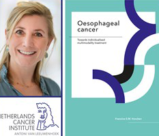 Thesis Defence Francine Voncken Personalize Oesophageal Cancer Treatment 1