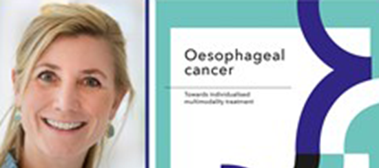 Thesis Defence Francine Voncken Personalize Oesophageal Cancer Treatment 1