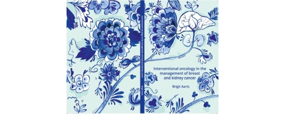 Thesis Defense Brigit Aarts