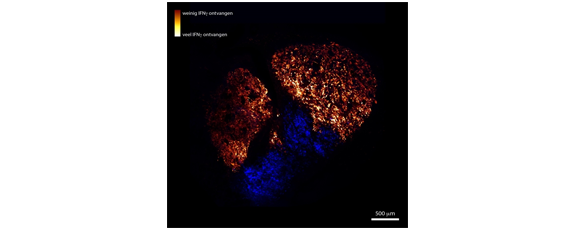 Immune Cells And Tumour Cells