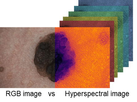 Spectraskin