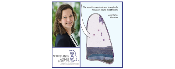 Thesis defense Laurel Schunselaars: The search for new treatment options for Mesothelioma