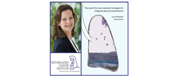 Thesis defense Laurel Schunselaars: The search for new treatment options for Mesothelioma