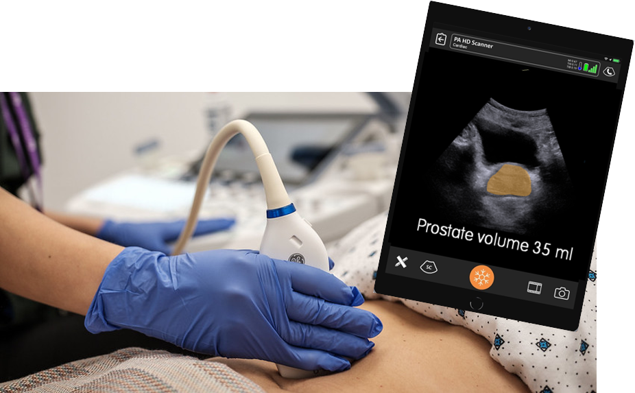 POCUS Prostate