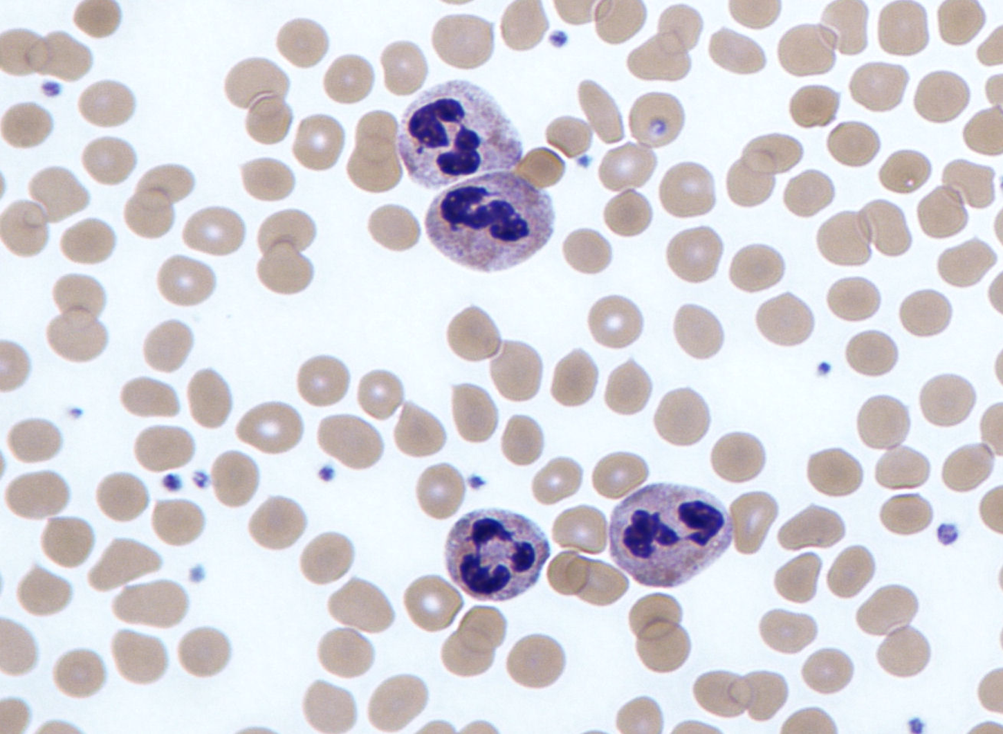Foto Neutrophils Kdv