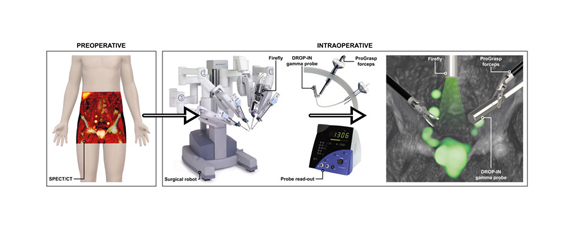 Lymph Detector