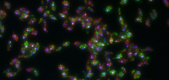 Microscope image of individual RNAs from two genes in yeast cells.