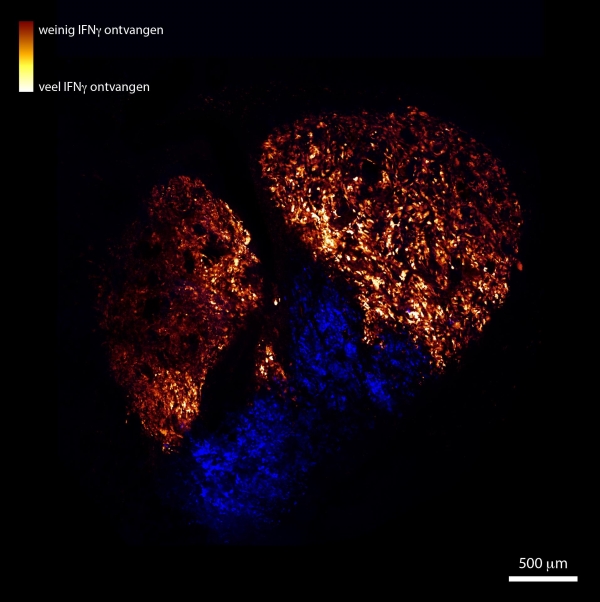 Immune Cells And Tumour Cells Wage War At A Distance