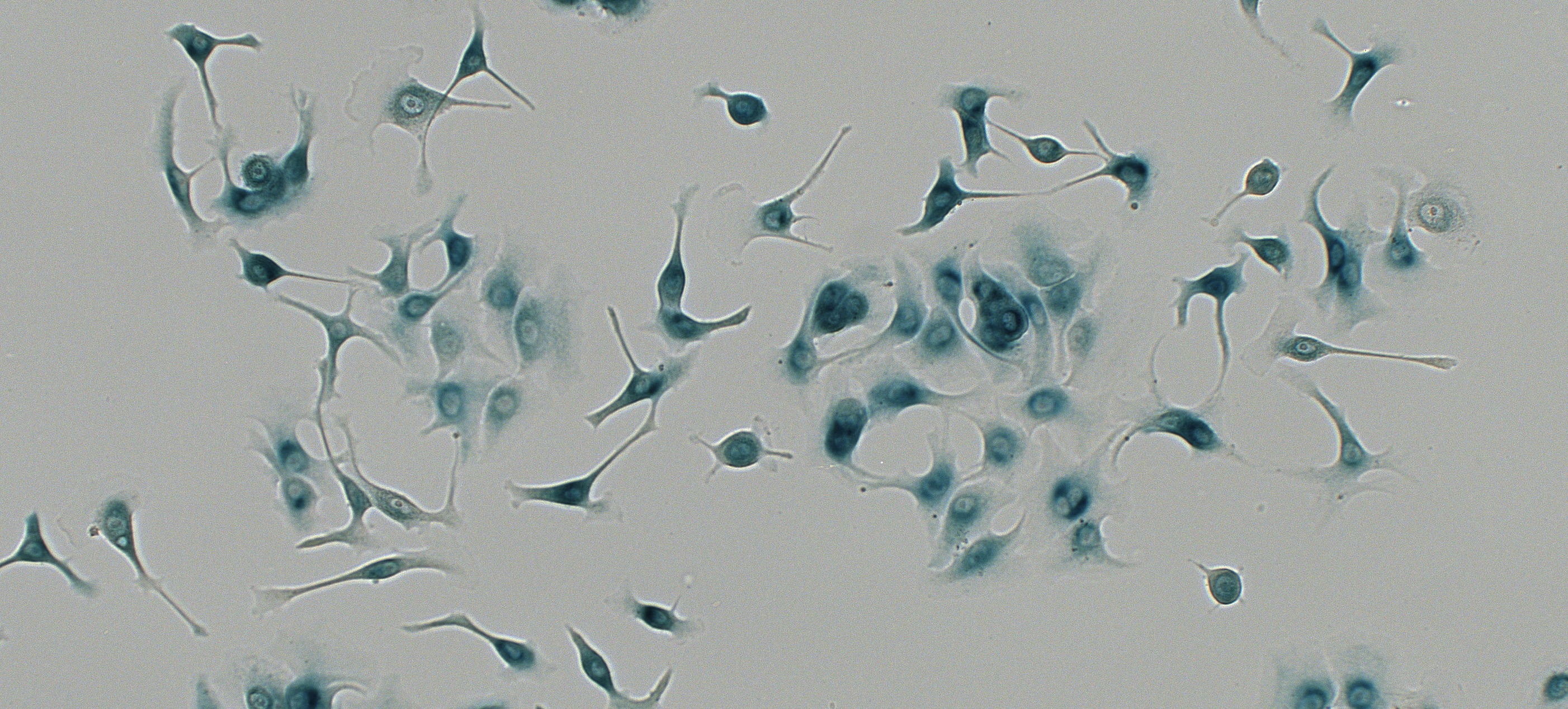 <p>Senescent cancer cells</p>