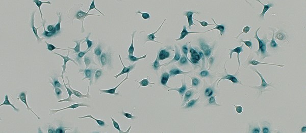 Senescent cancer cells
