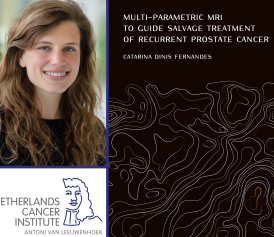 Thesis Defense Catarina Fernandes Localizing Recurrent Prostate Cancer 1