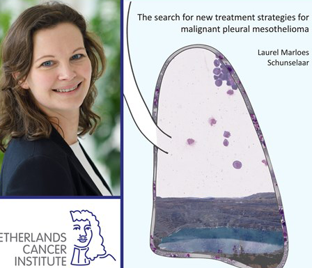 Thesis Defense Laurel Schunselaars The Search For New Treatment Options For Mesothelioma Preview Photo 1