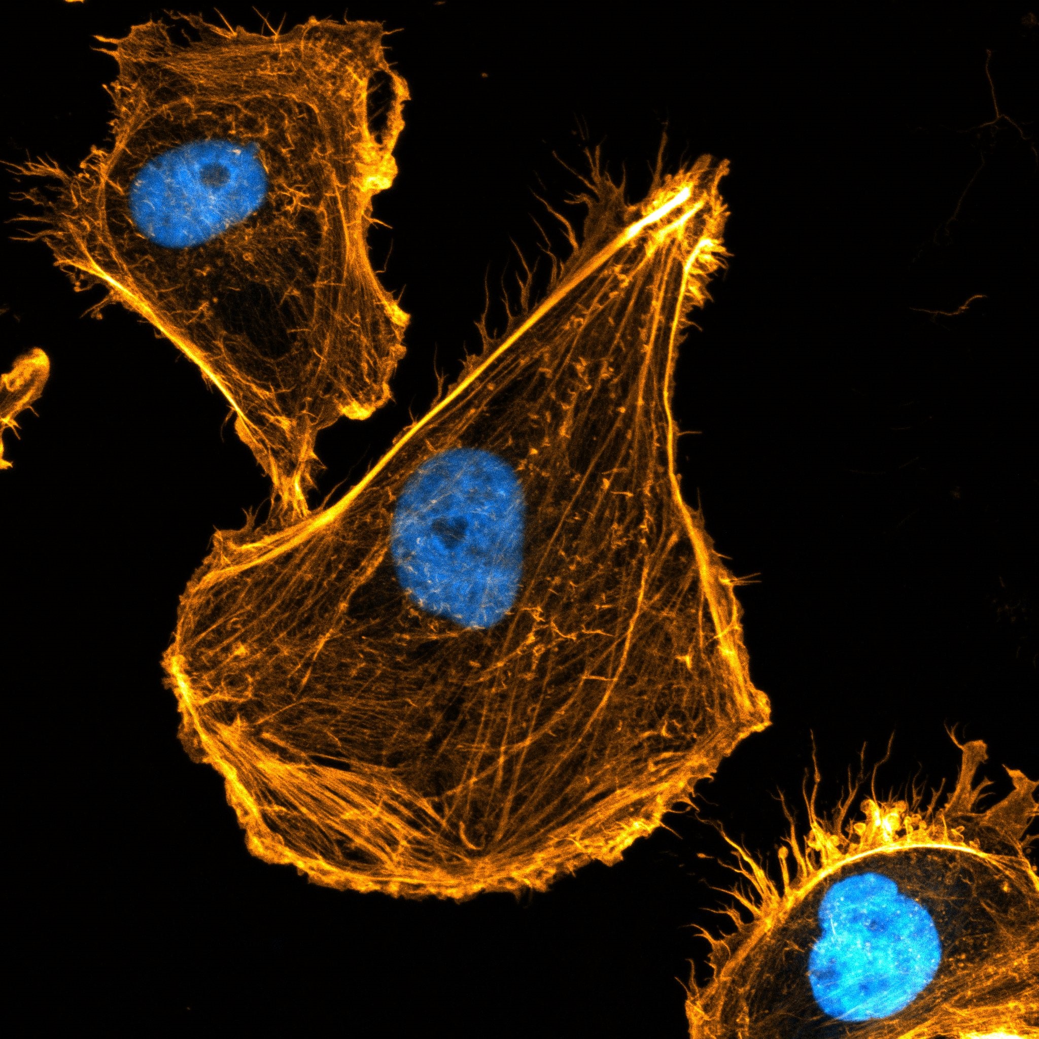 <p>Microscopy image of the actin skeleton, with nucleus in blue.</p>