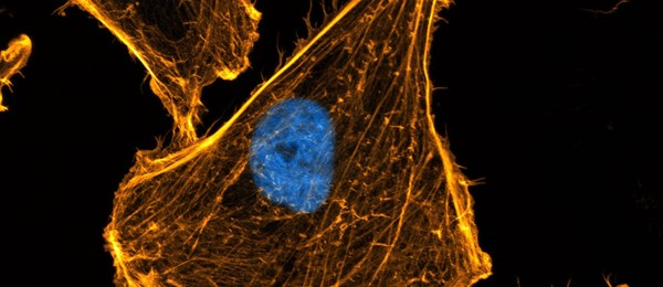 Actin with blue nucleus